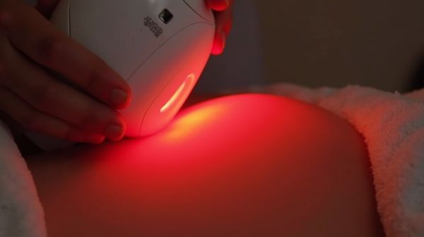 La thérapie par lumière rouge : comprendre la photobiomodulation